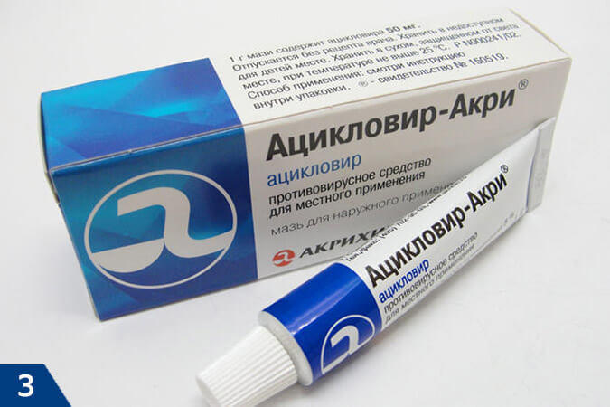 aciklovir
