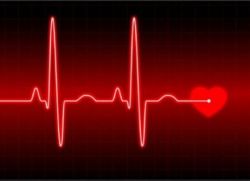 Причины тахикардии