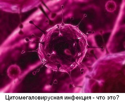 tsitomegalovirus