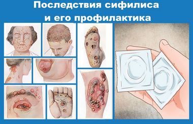 venericheskie-zabolevanija-i-ih-simptomy_1 (1)