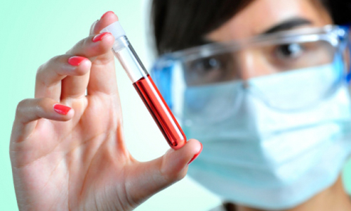 Анализы на холестерин Анализы на холестерин