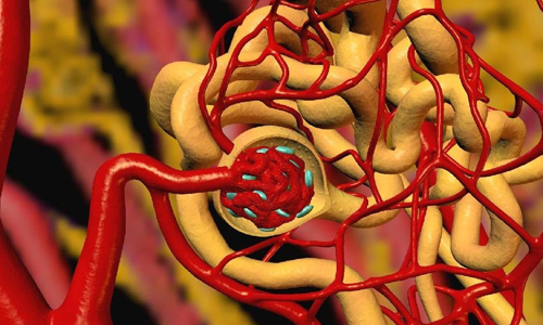 Атеросклеротические процессы в организме Атеросклеротические процессы в организме