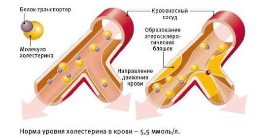 Движение холестерина в крови Движение холестерина в крови