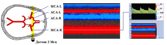 Глубина отображения допплеровского сигнала Глубина отображения допплеровского сигнала