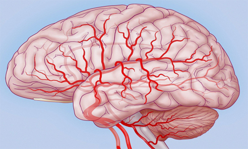 Хроническая энцефалопатия