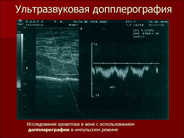 Импульсный режим