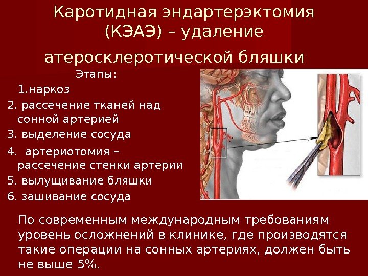 Этапы операции Этапы операции