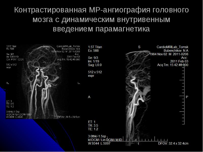 Контрастированная МР-ангиография Контрастированная МР-ангиография