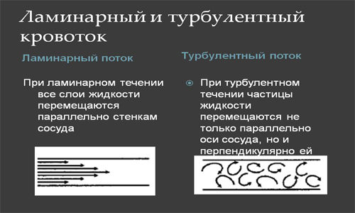 Ламинарный и турбулентный кровоток Ламинарный и турбулентный кровоток