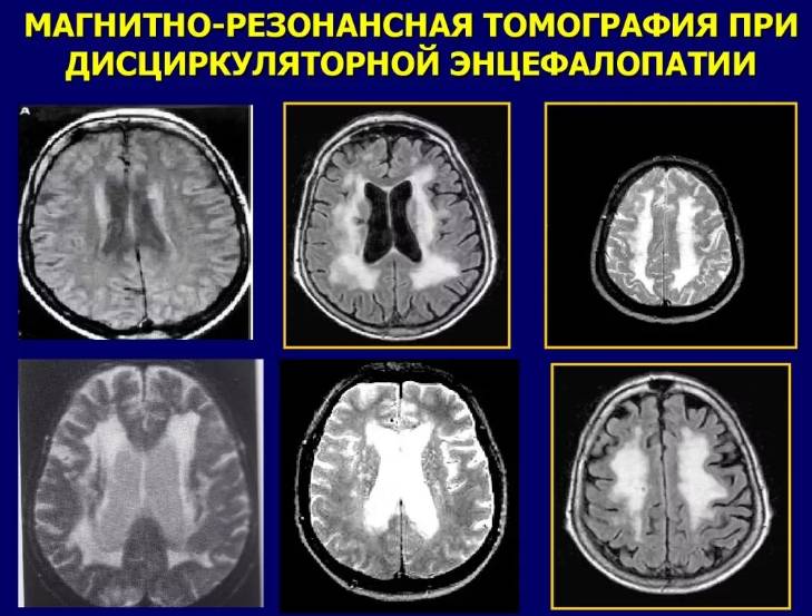 Магнитно-резонансная томография Магнитно-резонансная томография