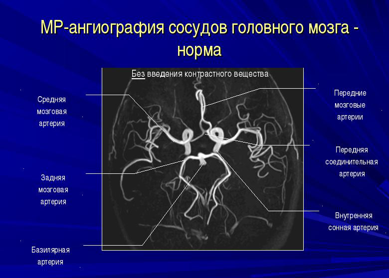 Нормы МР-ангиографии Нормы МР-ангиографии