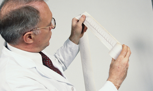 Обнаружение атеросклеротической болезни сердца Обнаружение атеросклеротической болезни сердца