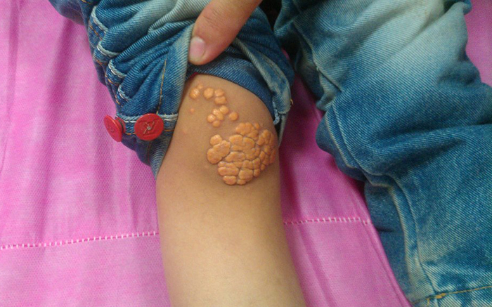 Образование ксантом Образование ксантом