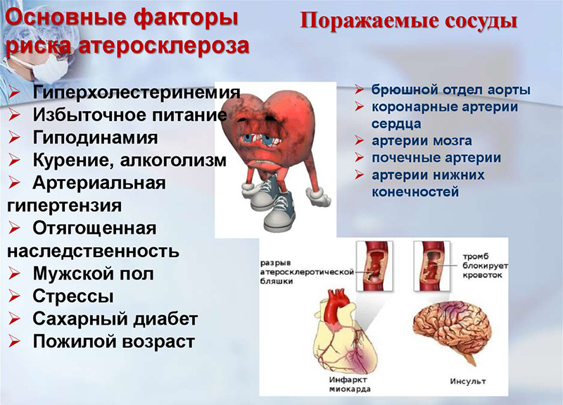 Основные факторы Основные факторы