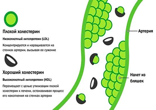 Плохой и хороший холестерин Плохой и хороший холестерин