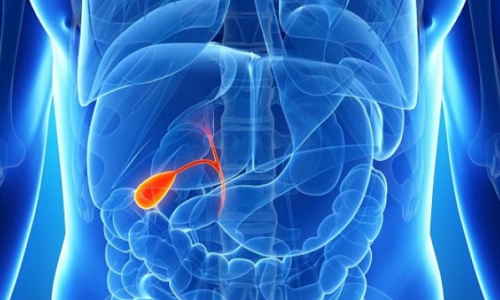 Появление холестериновых камней в желчном пузыре Появление холестериновых камней в желчном пузыре