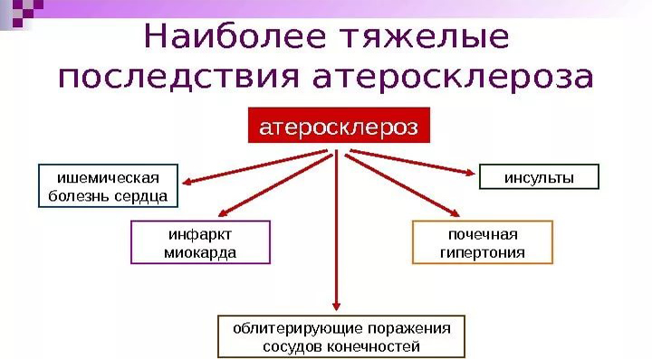 Последствия атеросклероза Последствия атеросклероза