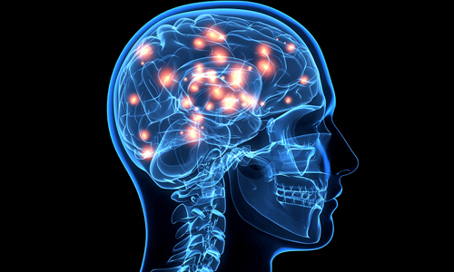 Проблема дисциркуляторной энцефалопатии