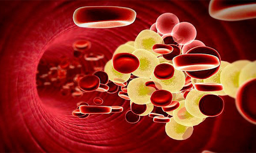 Проблема гиперхолестеринемии Проблема гиперхолестеринемии