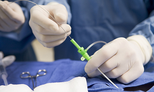 Проведение ангиографии сосудов ног Проведение ангиографии сосудов ног