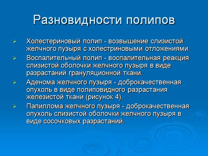 Разновидности полипов Разновидности полипов