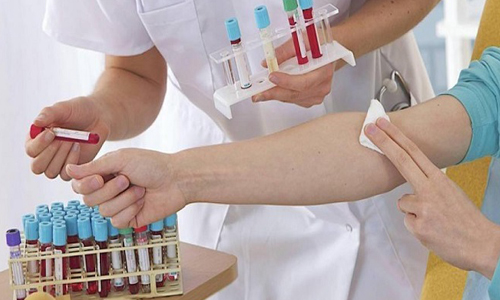 Сдача анализа крови на холестерин Сдача анализа крови на холестерин