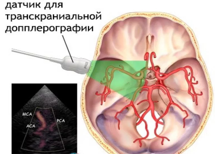 Схема исследования Схема исследования