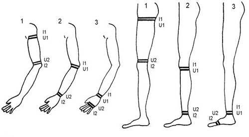 Схема расположения электродов Схема расположения электродов