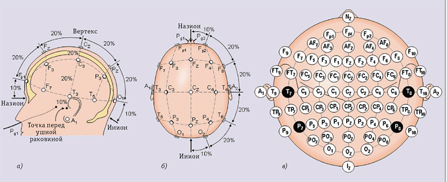 Схема размещения электродов Схема размещения электродов