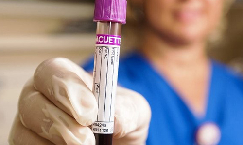 Сниженный холестерин в крови Сниженный холестерин в крови