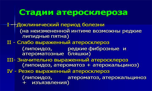 Стадии атеросклероза Стадии атеросклероза