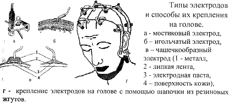 Типы электродов Типы электродов
