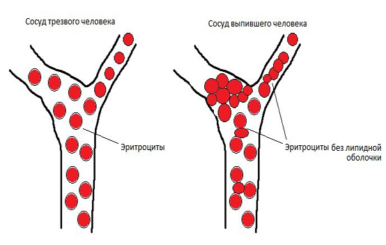 Влияние алкоголя на сосуды Влияние алкоголя на сосуды