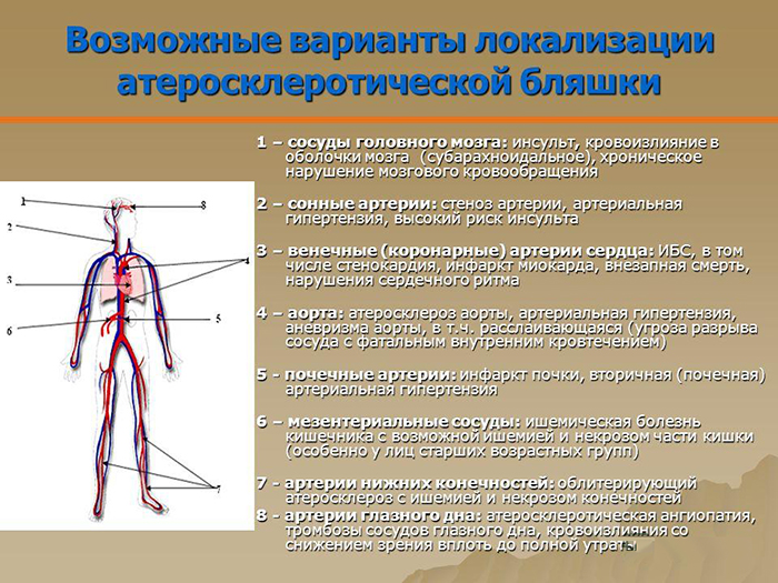 Возможные варианты локализации Возможные варианты локализации